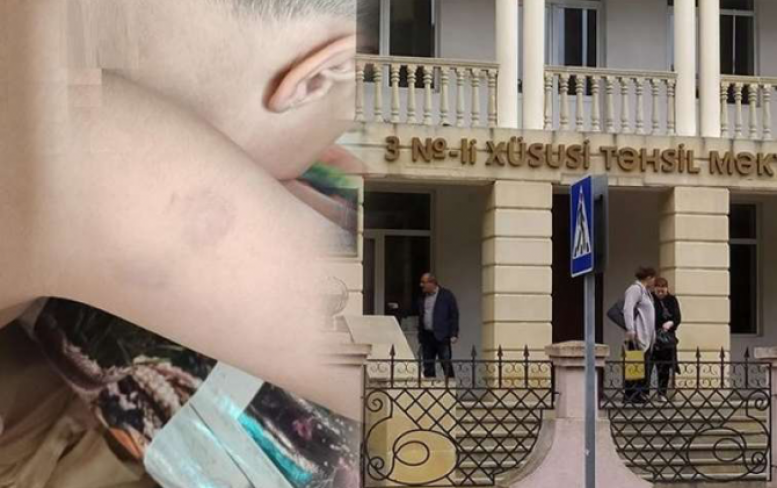 Müəllim autizmli uşağı DÖYDÜ - Rəsmi AÇIQLAMA - FOTO