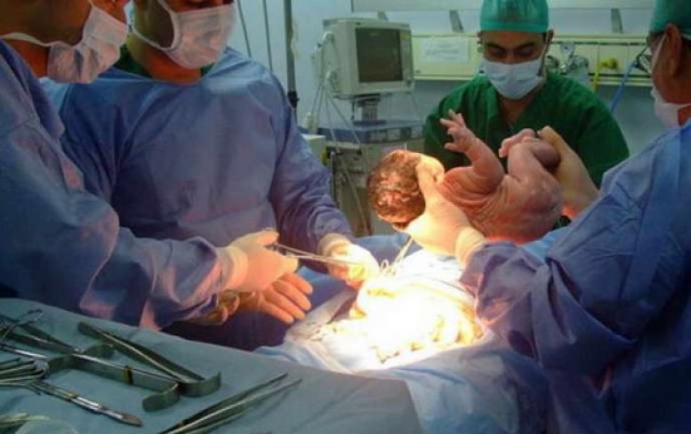 Ağcəbədidə ana doğuş zamanı öldü 